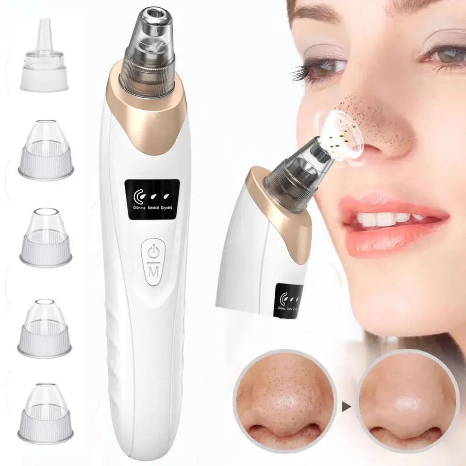 Blackhead Vacuum Remover – Deep Pore Cleaning System
