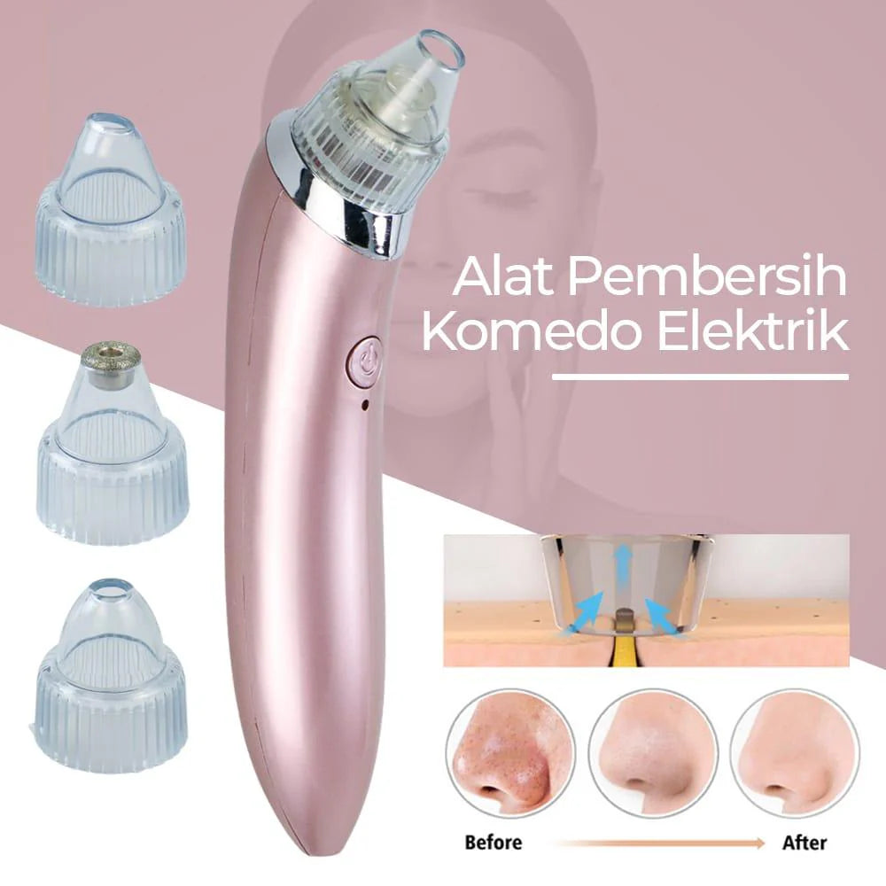 Blackhead Vacuum Remover – Deep Pore Cleaning System