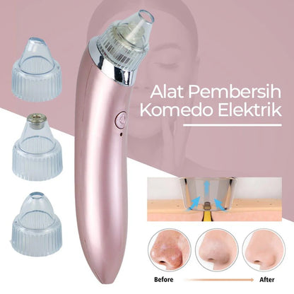 Blackhead Vacuum Remover – Deep Pore Cleaning System