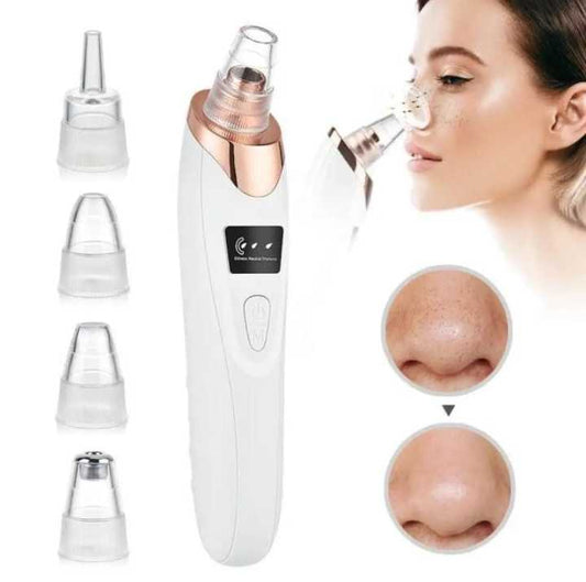 Blackhead Vacuum Remover – Deep Pore Cleaning System