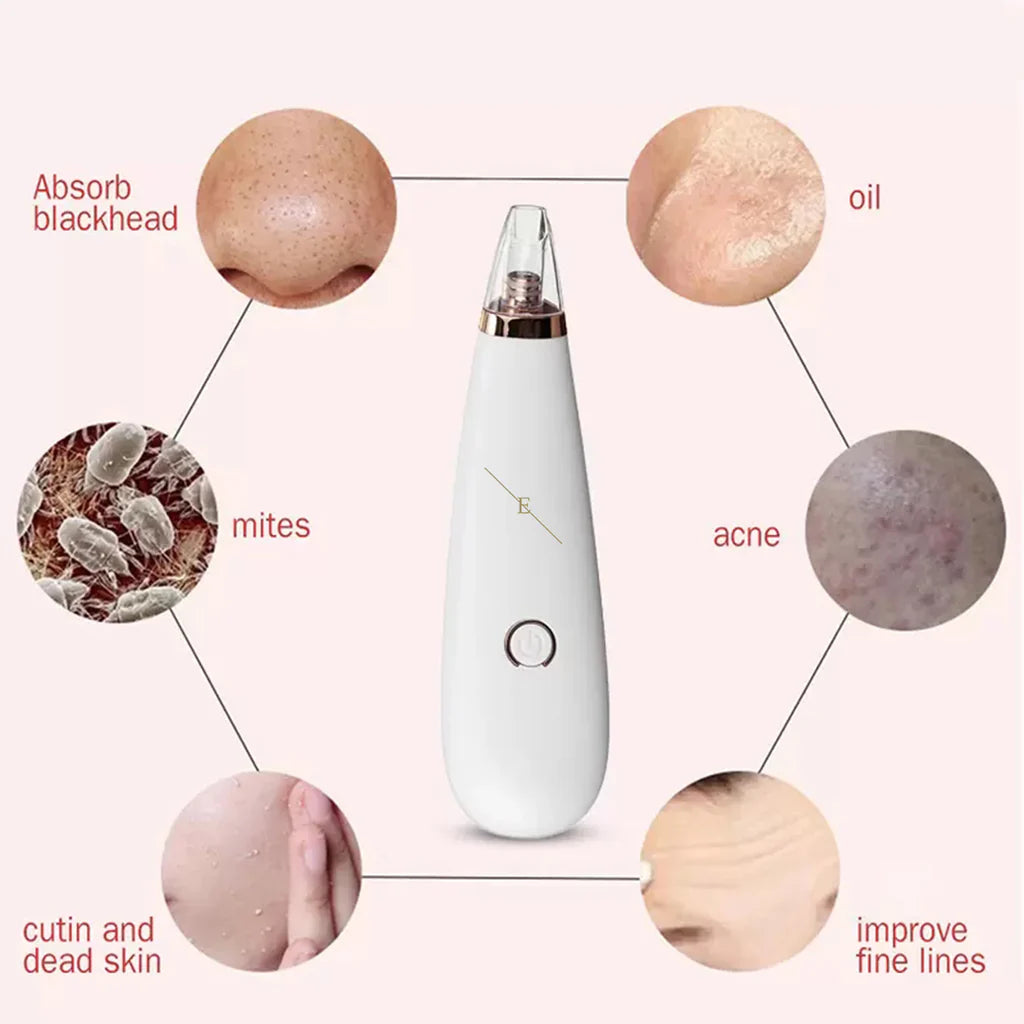 Blackhead Vacuum Remover – Deep Pore Cleaning System
