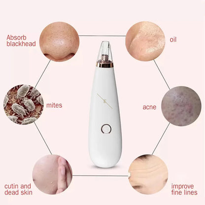 Blackhead Vacuum Remover – Deep Pore Cleaning System