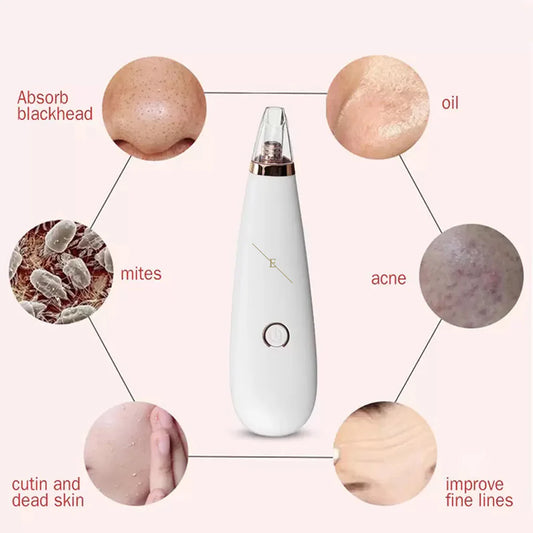 Blackhead Vacuum Remover – Deep Pore Cleaning System
